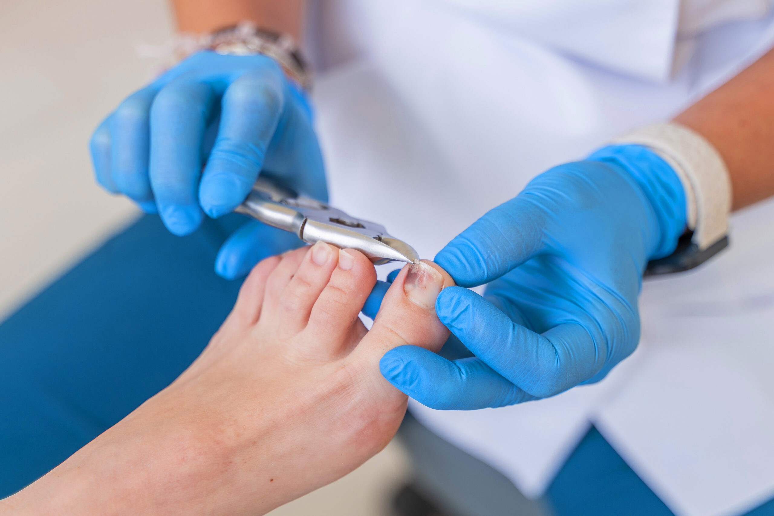 Foto de pie haciendo tratamiento Pie de riesgo