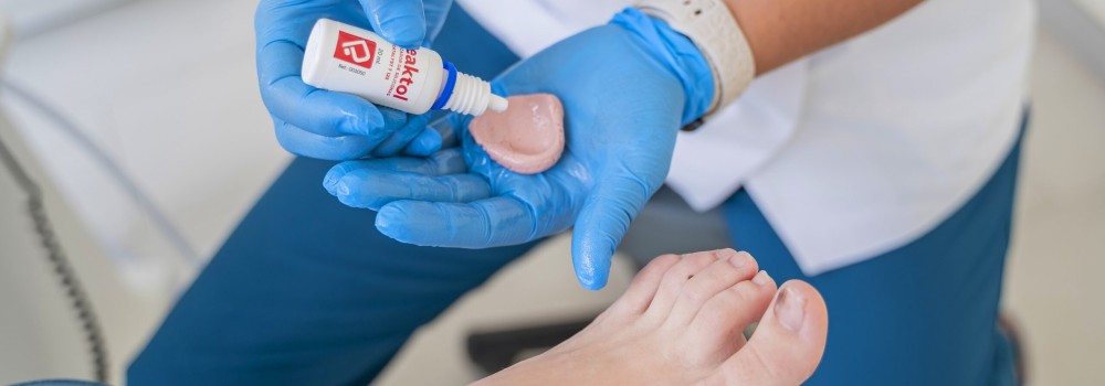 manos preparando la ortesis