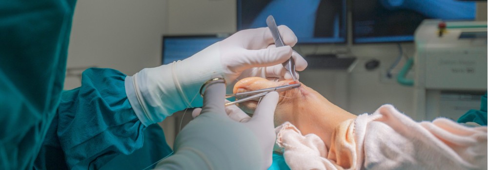 operación quirúrgica de pie