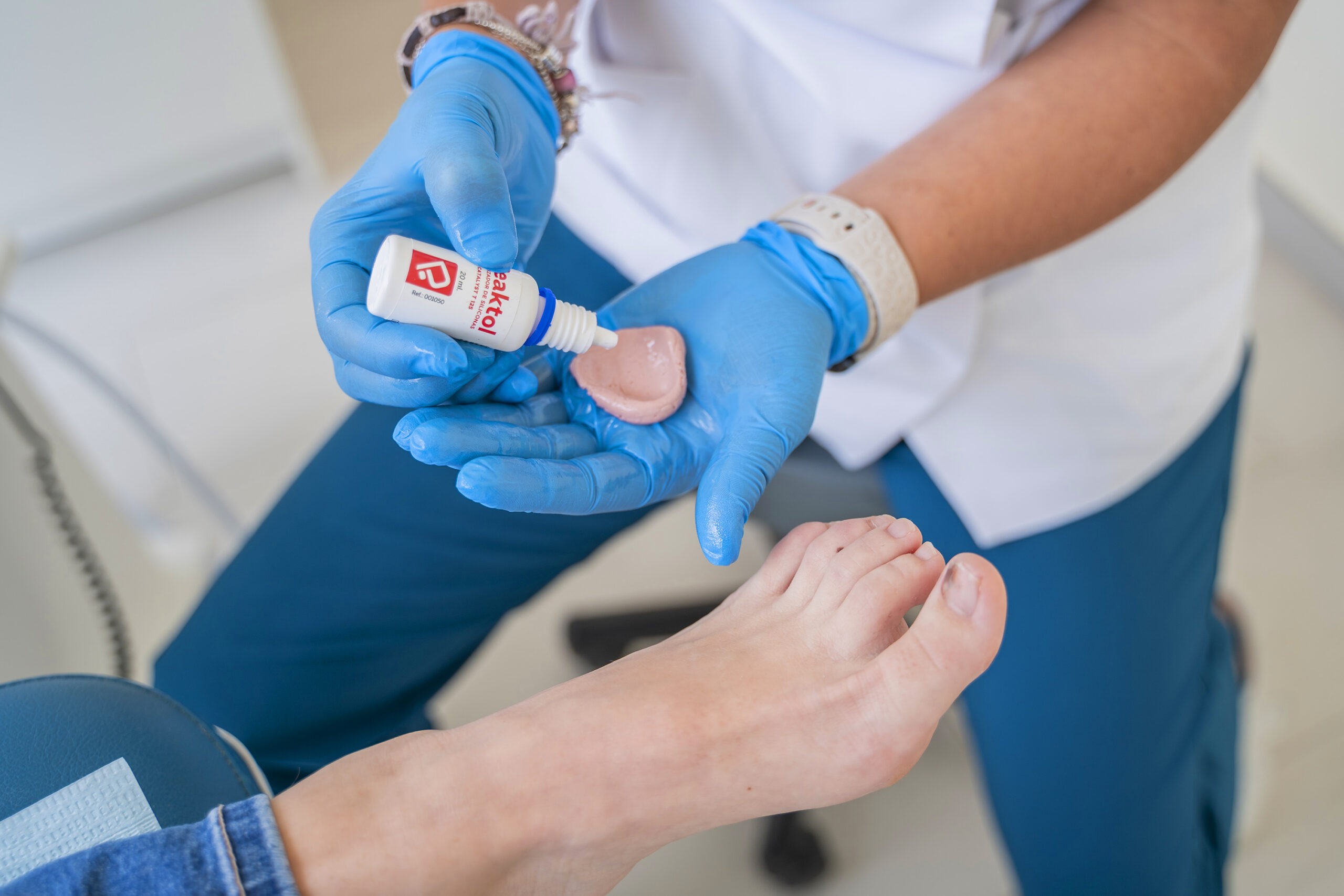 Foto de pie haciendo tratamiento Ortesis digitales de silicona